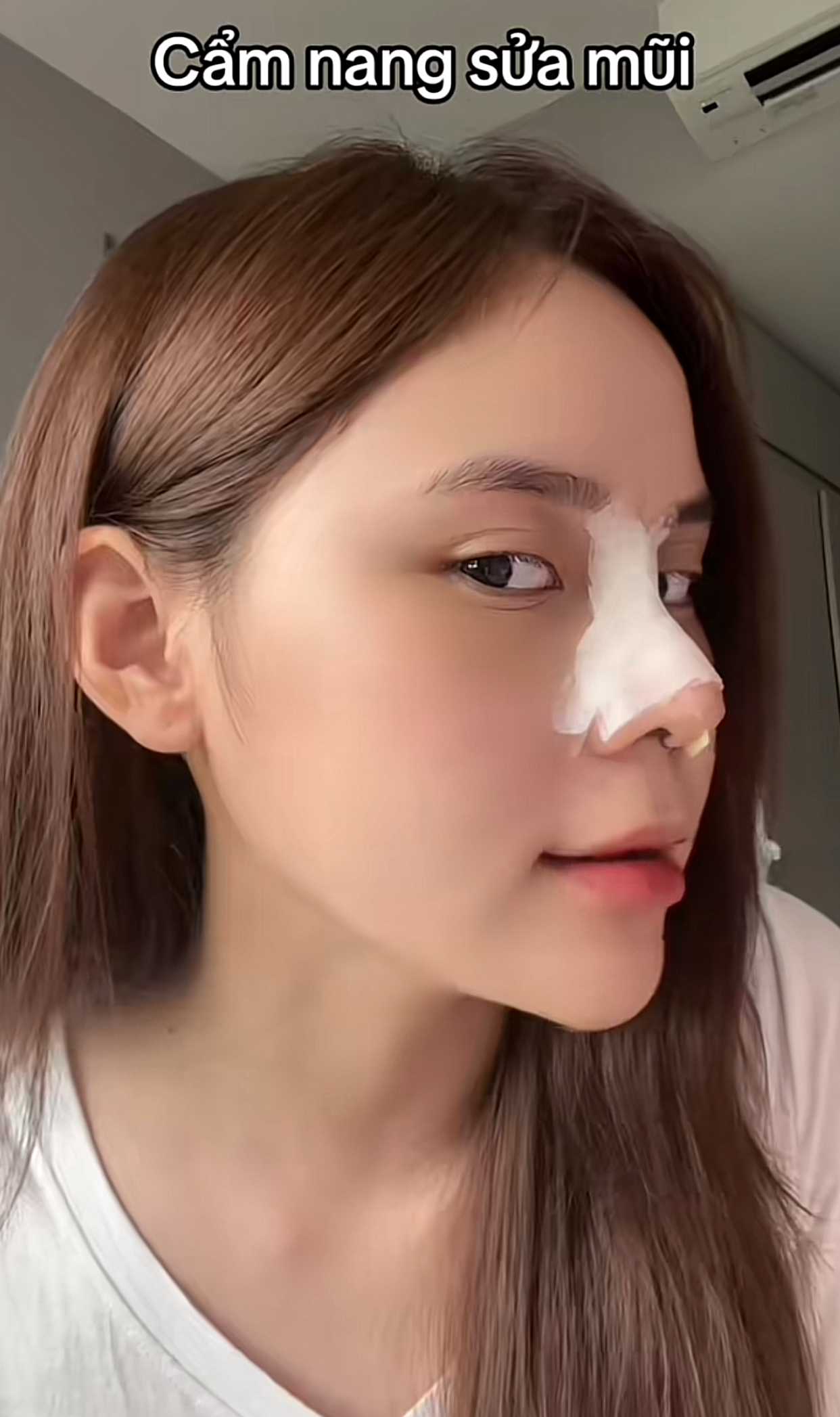 Hậu phẫu thuật thẩm mỹ, Hậu phẫu thuật thẩm mỹ,