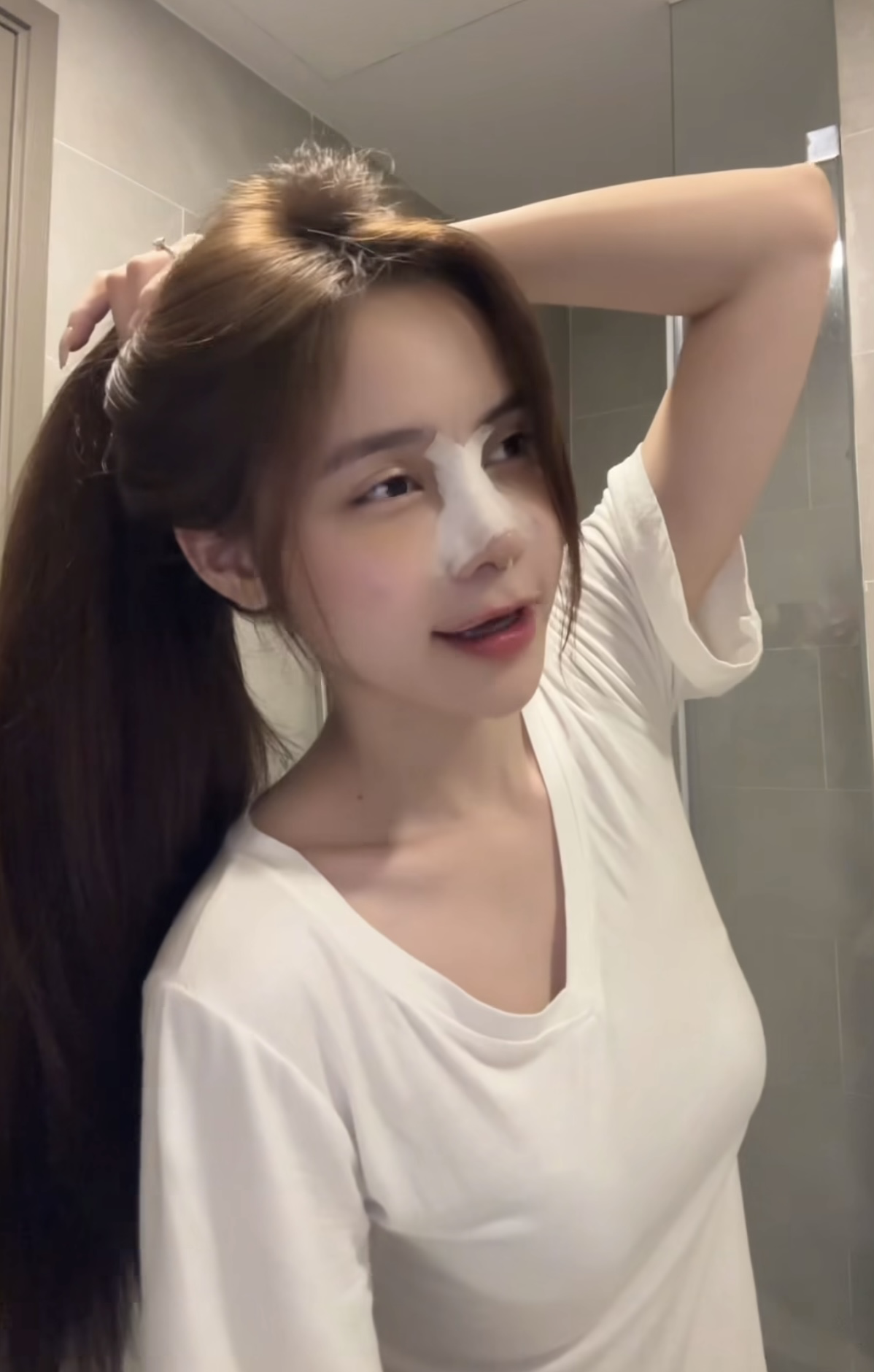 Hậu phẫu thuật thẩm mỹ, Hậu phẫu thuật thẩm mỹ,