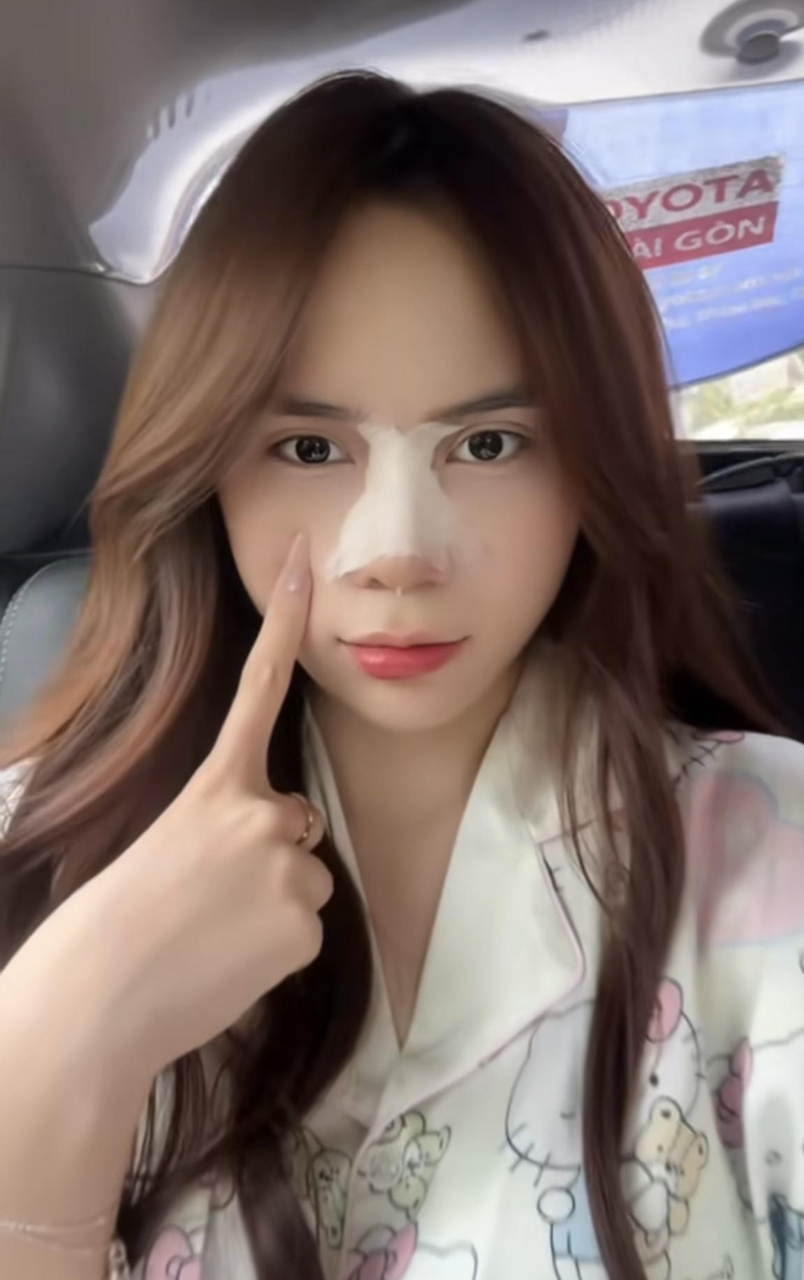 Hậu phẫu thuật thẩm mỹ, Hậu phẫu thuật thẩm mỹ,