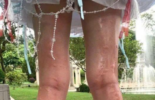 Nữ coser xinh đẹp “gặp hoạ” khi đang tác nghiệp, nhìn ảnh khiến người xem nào cũng phải xót xa